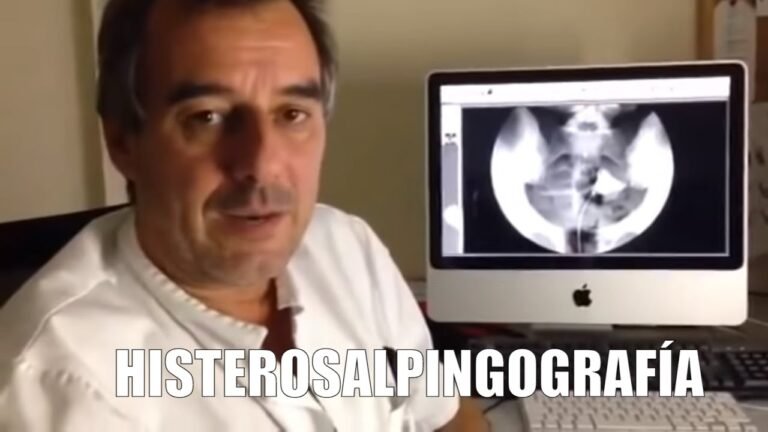 guia completa de histerosalpingografia definicion y proceso