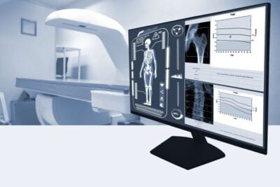 guia completa para realizar una densitometria osea eficazmente