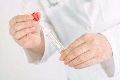 herramientas para medir cortisol en investigaciones cientificas