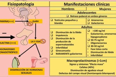 hiperprolactinemia todo lo que necesitas saber y sus efectos