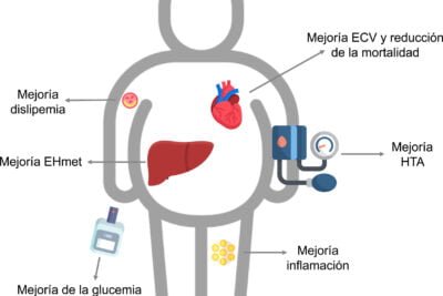 hipertension en pacientes obesos gestion por endocrinologos