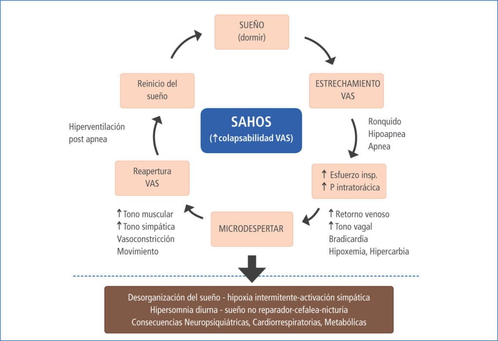 hipertension y apnea del sueno causas y efectos a considerar