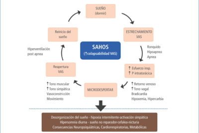 hipertension y apnea del sueno causas y efectos a considerar