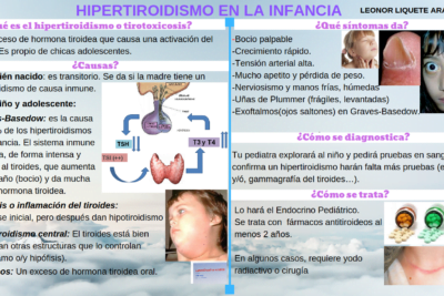 hipertiroidismo sintomas definicion y tratamiento de la enfermedad