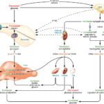 hipoglucemia reactiva causas sintomas y tratamiento explicado