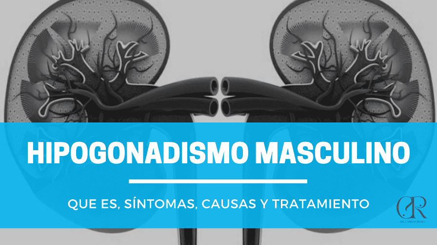 hipogonadismo causas sintomas y lo que necesitas saber