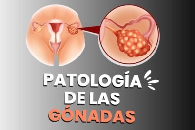 hipogonadismo causas sintomas y tratamiento explicados