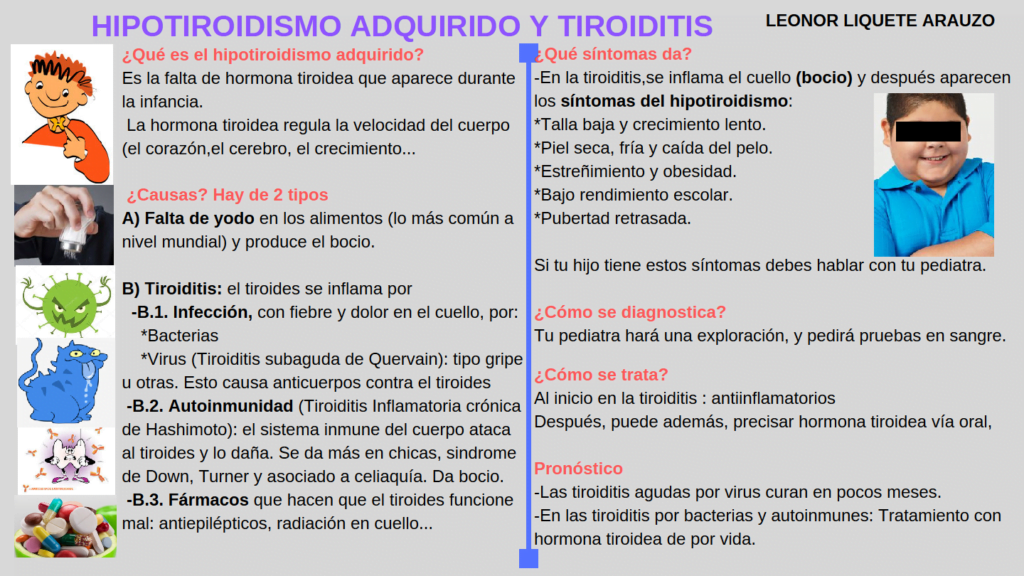 hipotiroidismo autoinmune causas sintomas y tratamientos clave