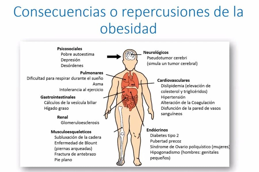 Impacto cultural en la obesidad y sus consecuencias sociales 1 impacto cultural en la obesidad y sus consecuencias sociales