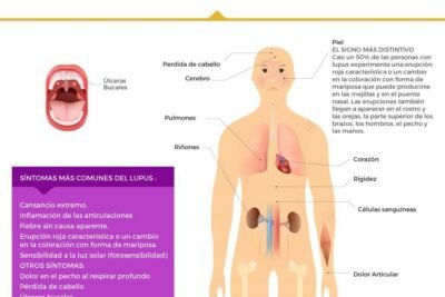 impacto de enfermedades autoinmunes en el bienestar hormonal