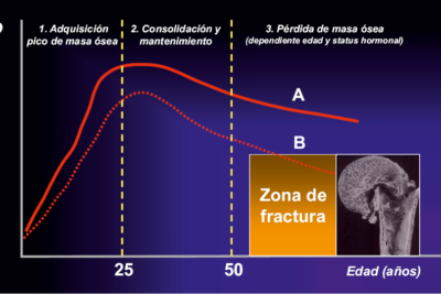 impacto de hormonas en la densidad osea durante la vida