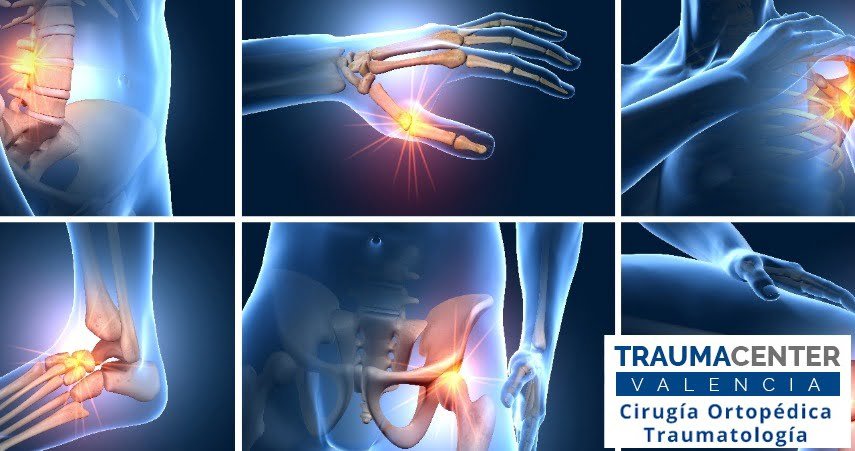 impacto de la insulina en la salud osea que debes saber