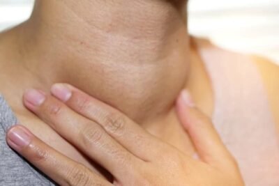 impacto de la tirotoxicosis en la piel sintomas y tratamientos