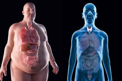 impacto de las enfermedades tiroideas en otros organos del cuerpo