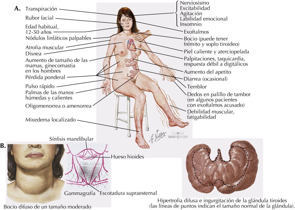 impacto del tiroides en la salud de la piel humana