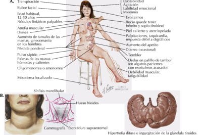 impacto del tiroides en la salud de la piel humana