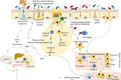 influencia de la microbiota intestinal en enfermedades autoinmunes