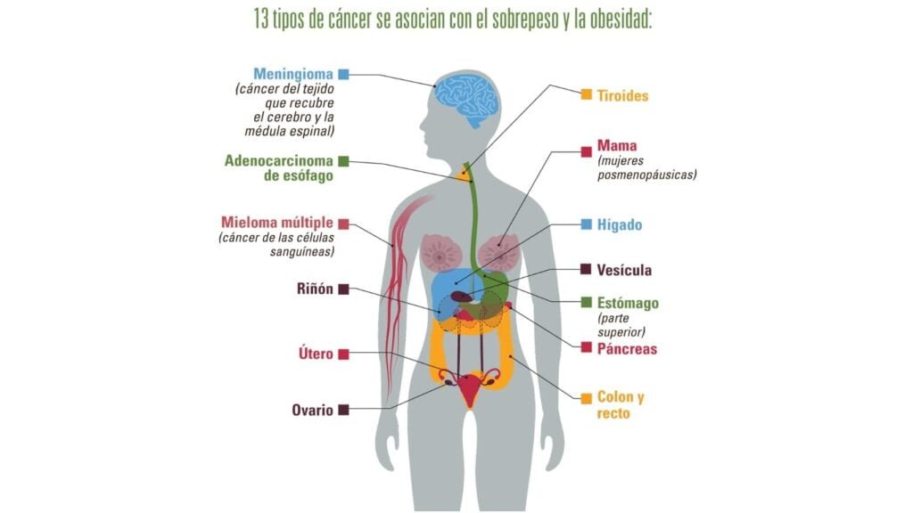 influencia de la obesidad en el desarrollo y tipos de cancer