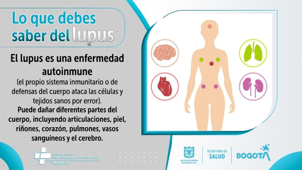 iniciativas de salud publica sobre enfermedades autoinmunes