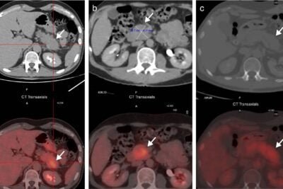 inmunoterapia en neuroendocrinologia definicion y aplicaciones