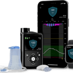 innovaciones recientes en bombas de insulina tecnologias clave