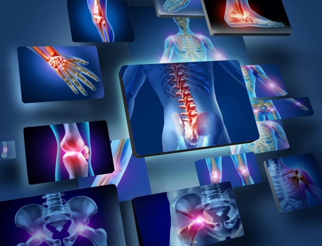 innovaciones tecnologicas en el diagnostico de osteoporosis