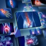 Innovaciones tecnológicas en el diagnóstico de osteoporosis