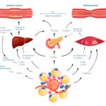 insulina e inflamacion relacion y su impacto en la salud humana