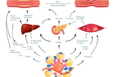 insulina e inflamacion relacion y su impacto en la salud humana