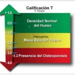 Interpretación de resultados de densitometría ósea