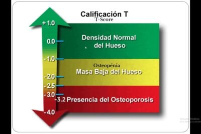 interpretacion de resultados de densitometria osea