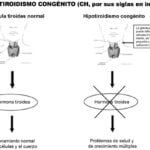 Investigaciones sobre herencia genética y tirotóxicosis