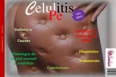 lipodistrofia definicion y relacion con las hormonas