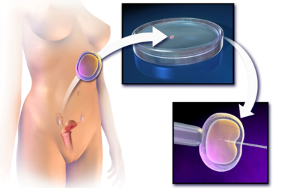 manipulacion hormonal en tratamientos de infertilidad como se hace