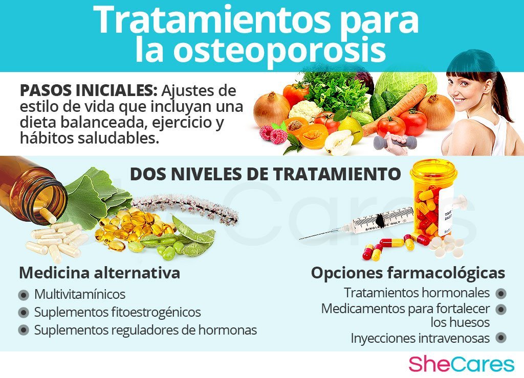 metodos alternativos para tratar la osteoporosis