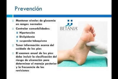 neuropatia diabetica causas y sintomas que debes conocer