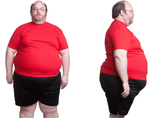 Obesidad en hombres: Causas, efectos y posibles soluciones 1 obesidad en hombres causas efectos y posibles soluciones