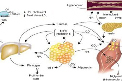 obesidad y su vinculo con el desequilibrio hormonal en el cuerpo