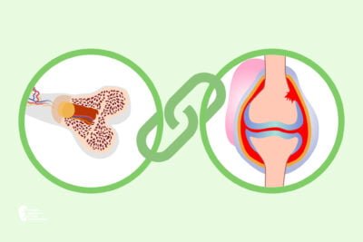 perspectivas y desafios en la investigacion de la osteoporosis