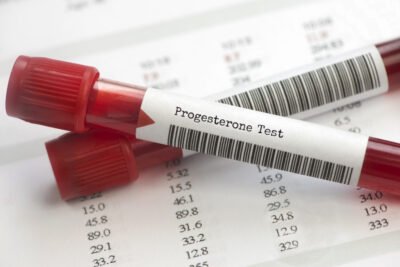 progesterona sintetica usos y todo lo que necesitas saber