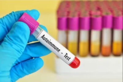 pruebas de laboratorio para diagnosticar enfermedades autoinmunes