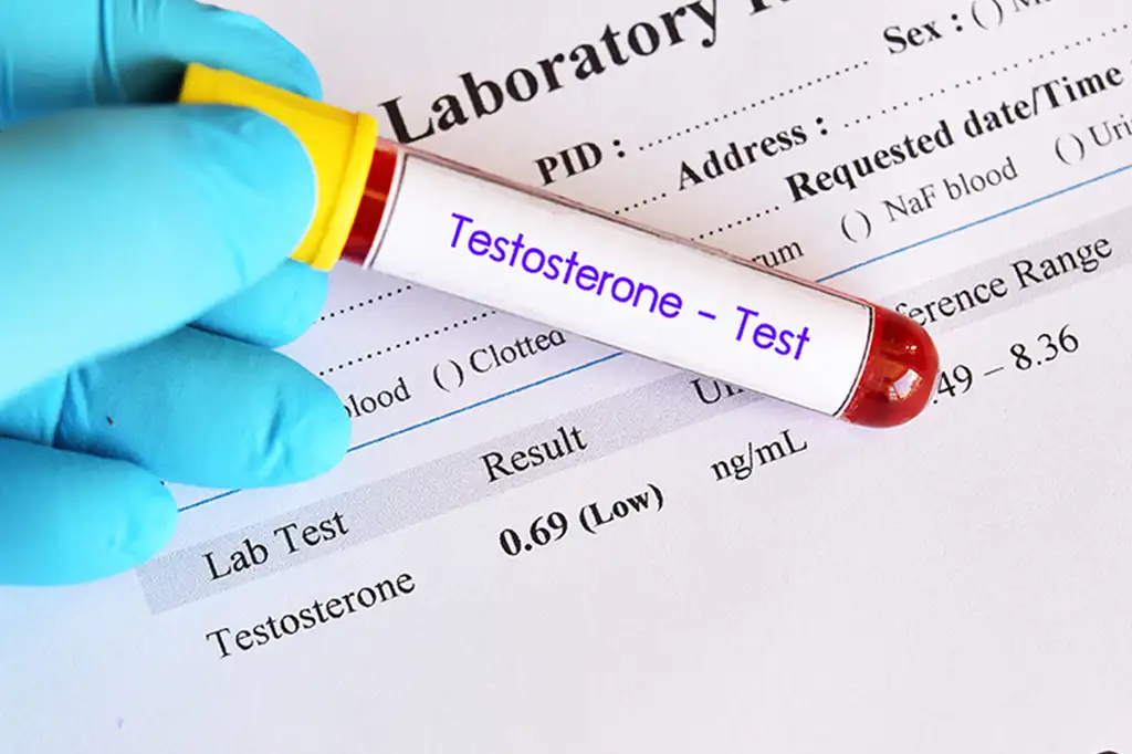 Pruebas de laboratorio para estudiar la testosterona en humanos 1 pruebas de laboratorio para estudiar la testosterona en humanos