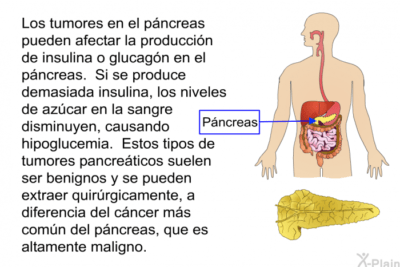 que es el pancreas y su relacion con la hipoglucemia