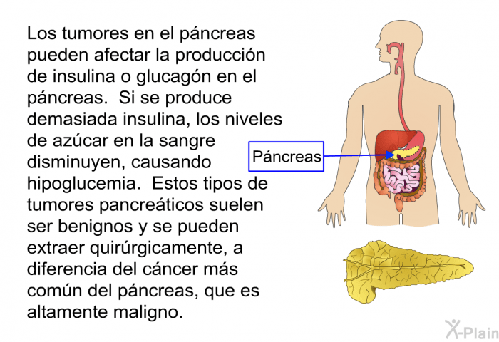 Qué es el páncreas y su relación con la hipoglucemia 1 que es el pancreas y su relacion con la hipoglucemia