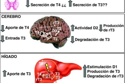 que es el sindrome de resistencia a hormonas tiroideas