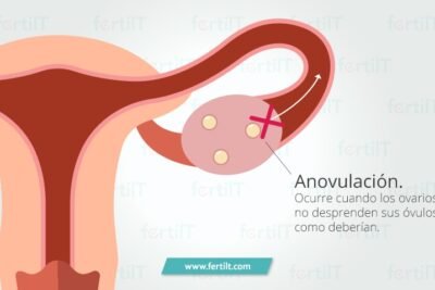 que es la anovulacion y su relacion con androgenos
