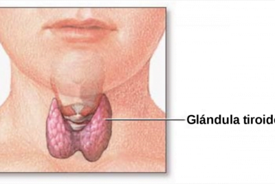 que es la cirugia de tiroides y cuando se necesita