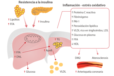 que es la diabetes y su relacion con la dislipidemia