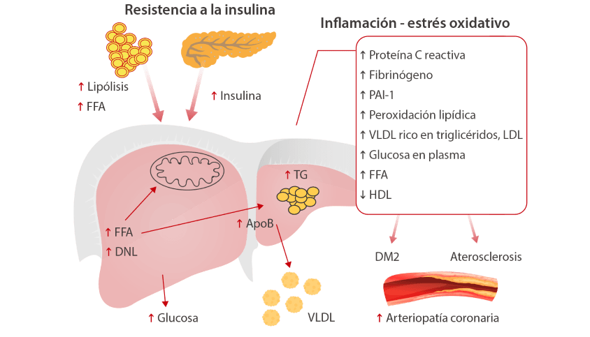 que es la diabetes y su relacion con la dislipidemia