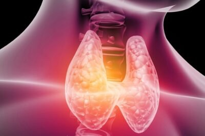 que es la disfuncion tiroidea y como afecta la salud general